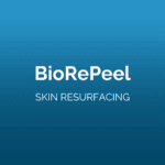 BioRePeel CL3 Face